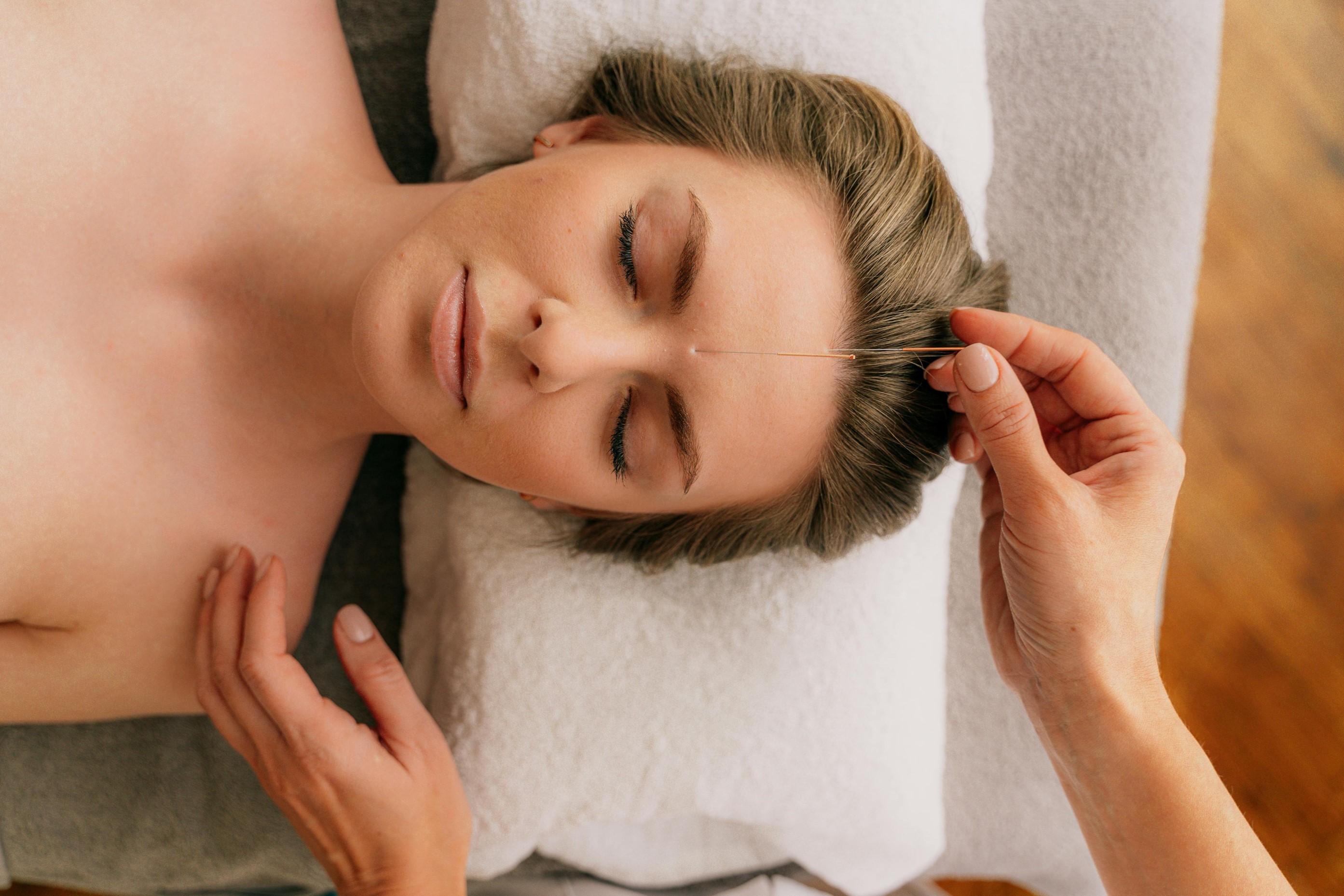 Acupuncture for Chronic Pain
